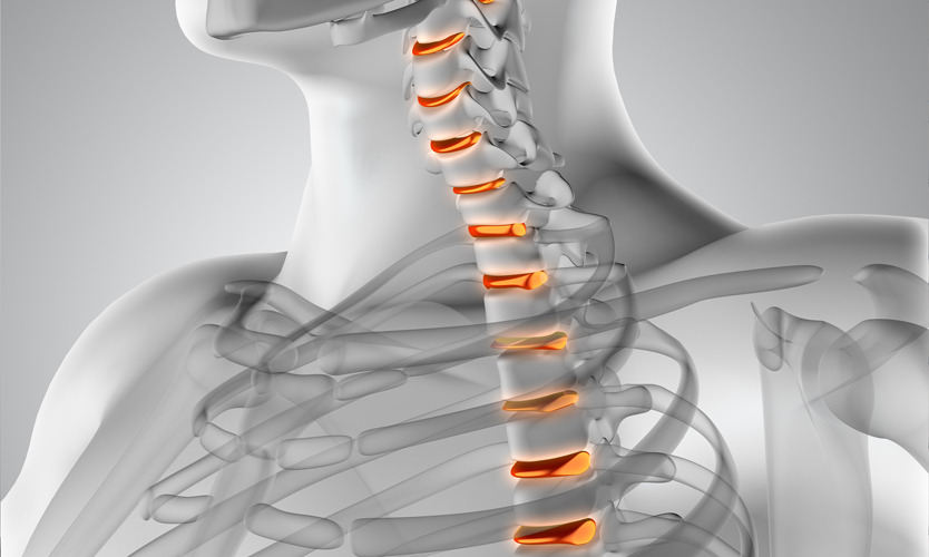 مشکلات ستون فقرات دکتر کامران غفرانی