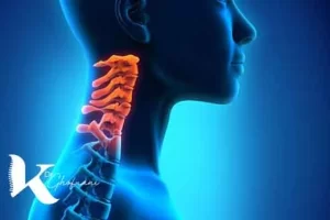 آرتروز گردن