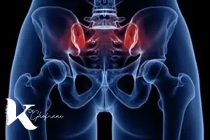 التهاب مفصل ساکروایلیاک