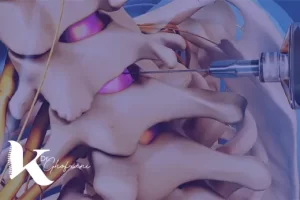 تزریق دیسکوژل