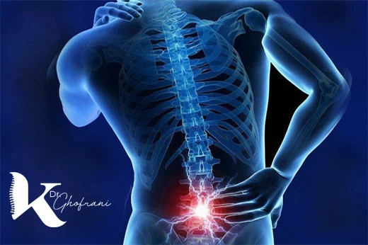 تنگی-کانل-نخاعی