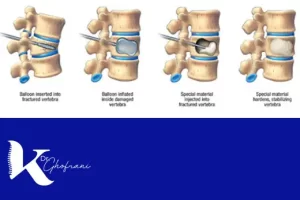 سمنتوپلاستی