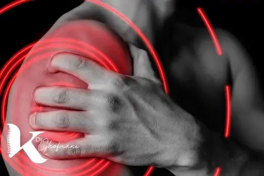 شانه یخ زده