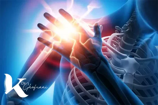 شانه یخ زده