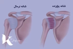 عوامل ایجاد <yoastmark class=