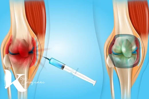 اوزون درمانی برای درمان دردهای مفصلی