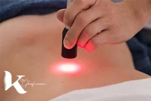 لیزر درمانی برای درمان دیسک کمر