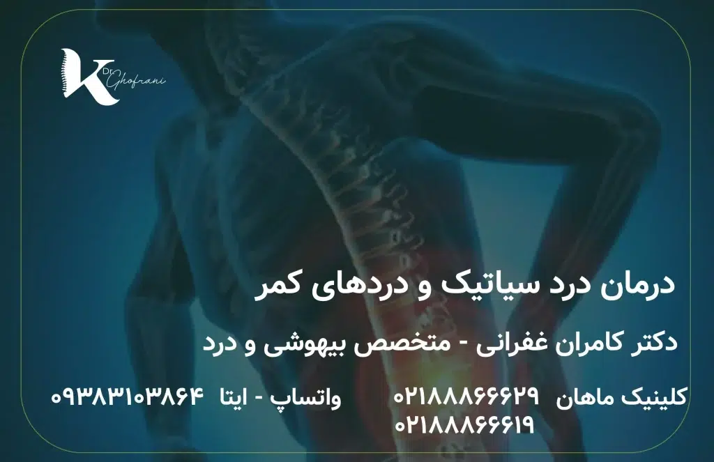 درمان درد سیاتیک