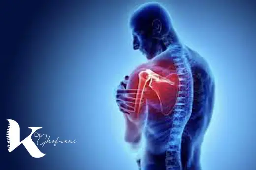 اسپاسم عضلانی چیست؟