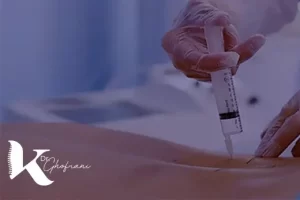 تزریق اپیدورال