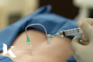 درمان دیسک کمر با تزریق دیسکوژل